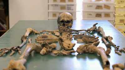 This skeleton show
many traces of trauma - Lost Treasures of Rome