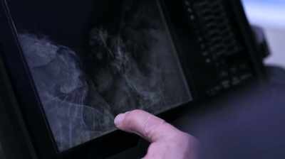 This is the second
primary molar... - Pompeii: Secrets of the Dead