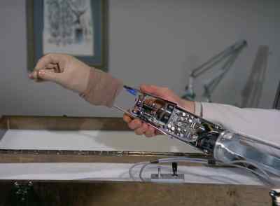 This is your arm, Steve. - The Six Million Dollar Man