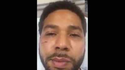  To make it look real like
he really did get his ass beat. - Jussie Smollett: Anatomy of a Hoax