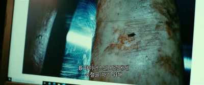 To transfuse blood - Vanishing