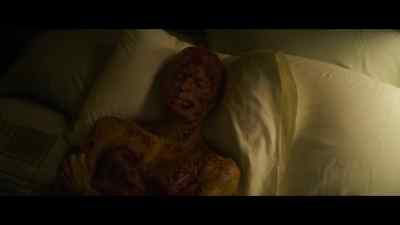 Try not to scratch. - Let the Right One In