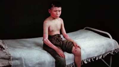 TWO MILES AWAY,
SKIN SPONTANEOUSLY IGNITED. - The Pacific War in Color