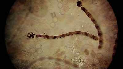 Typhus, anthrax, tuberculosis. - Origins: The Journey of Humankind