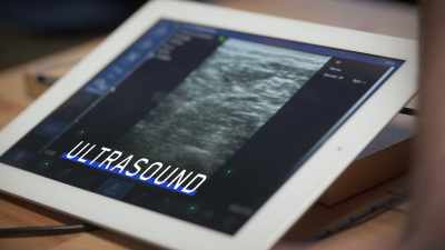 Ultrasound provides an image, - The Age of A.I.