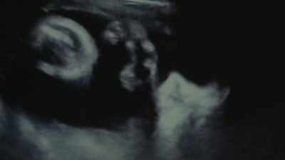(ultrasound whirring) - Night Is Not Eternal