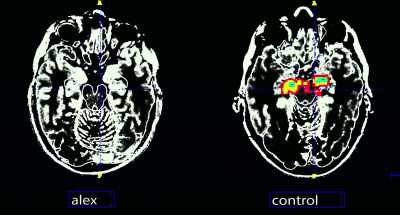 Um, do you think my amygdala actually
just doesn't work or something? - Free Solo