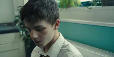 Um, doesn't look like you
knocked out any teeth. - Adolescence