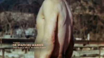 WARREN: We weren't
particularly interested
in skin burns. - Hiroshima and Nagasaki: 75 Years Later