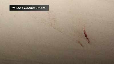 We were able to note that
there was some cast-off blood - Final Moments