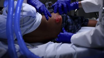 - We call that
a pressure ulcer. - Chicago Med