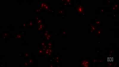 We call it the cosmic microwave
background radiation. - Brian Cox: Life Of A Universe