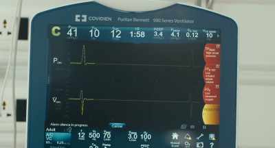 We can only continue to
put him on a ventilator - Breath of Life