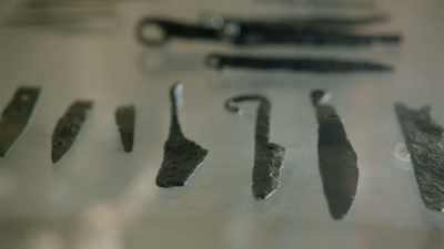 We can see evidence
of minor surgeries - Origins: The Journey of Humankind
