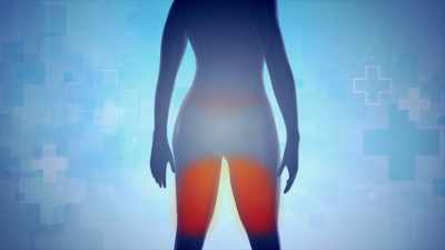 We do a little more liposuction
above the butt, - Impact x Nightline
