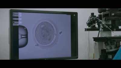 We have a fertilized egg with a sperm, - Unnatural Selection