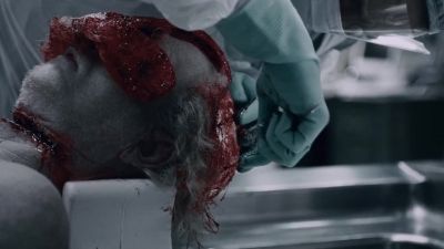 We have a recent
rectangular transection - Saw IV