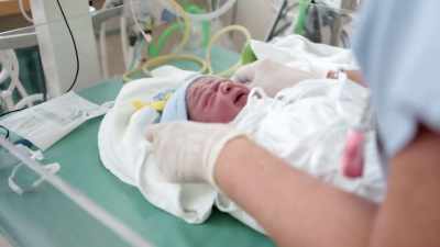 We have separated out
the prosthetic arm - Human: The World Within