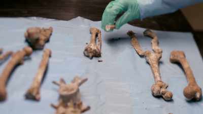 We looked at each bone
under a microscope - Casey Anthony: An American Murder Mystery