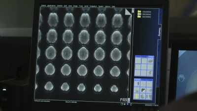 We need to see the impact
that it's having on the brain - A Brief History of the Future