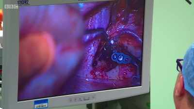 We really do not want anything
to go wrong. - Surgeons: At the Edge of Life
