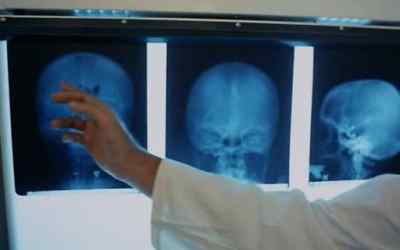 We removed a tumor from,
her brain. But we... - Turkish Delight