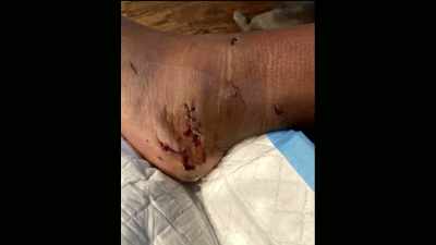 We see Rihanna's battered
and bruised face, - Chris Brown: A History of Violence