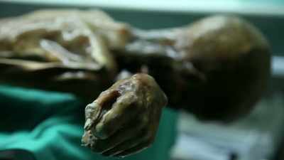 We think he died of blunt force
trauma to the head. - Origins: The Journey of Humankind