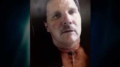 Well, I couldn't talk
because during surgery, - Dr. Death: The Undoctored Story