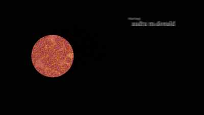 ♪ We'll meet again ♪ - The Bite