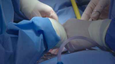 We're in surgery
to remove eebi's mass, - Secrets of the Zoo