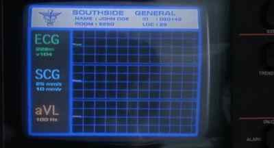 We're losing him. - Ghost in the Machine