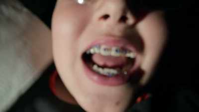 We're taught that genetics
plays the primary role - Open Wide