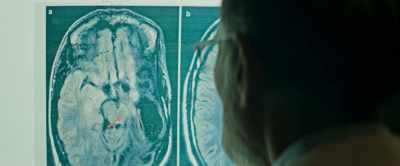 What are you looking at?
It's cancer. - Pathaan