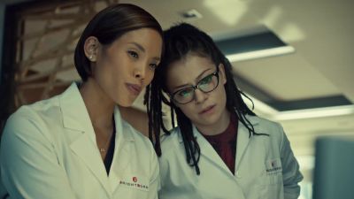 What are those striations?
Nerves? - Orphan Black