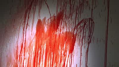 - What are we looking at here? - Dexter