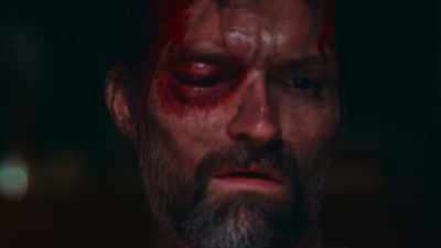 -What does that mean? - A Wounded Fawn