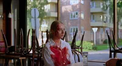 - What happened?
- I got bit. - Sick of Myself