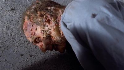 What happened to this man? - The X-Files