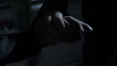 No! What is... What the hell are you doing! It'll heal. - It still hurts! - And that's what keeps yo - Teen Wolf