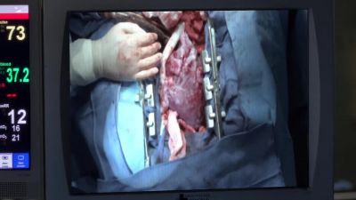 - What is it?
- Her rhythm is deteriorating. - Grey's Anatomy