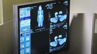When we did the ct scan, - Secrets of the Zoo