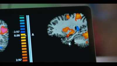 When we look at dad's brain,
we saw quite a different story. - Babies