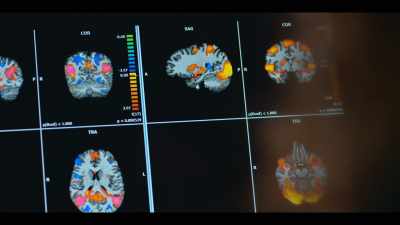 When we looked at mom's brain, - Babies