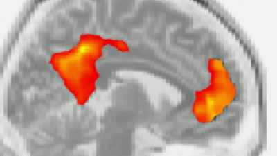 When people remembered,
a particular network lit up, and... - The Mind, Explained