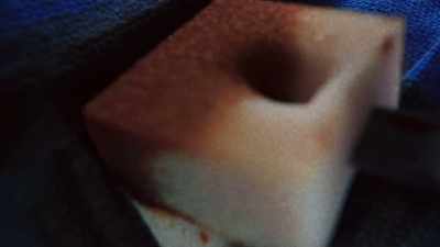 When she sanitized
the surgical area... - The Resident