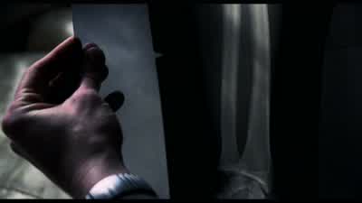 Where did this come from? - Hannibal