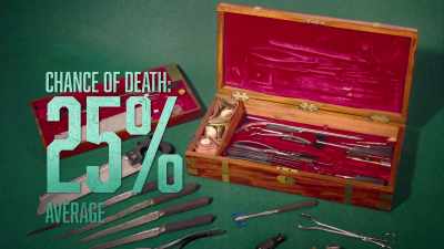 Where most surgeons at the
time have a 25% mortality rate, - The UnBelievable with Dan Aykroyd