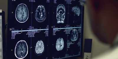 While there's been fantastic
work at mapping
neural connections - Close Encounters of the Fifth Kind