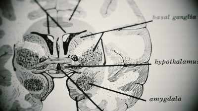 While under the influence of stimulation Leonard agree to the surgery, - The Minds of Men